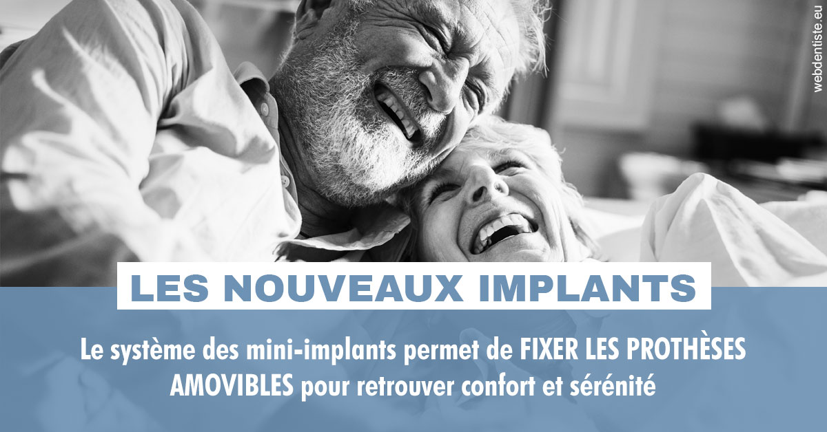 https://dr-nezri-mickael.chirurgiens-dentistes.fr/Les nouveaux implants 2