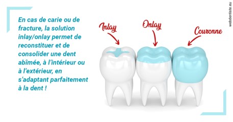 https://dr-nezri-mickael.chirurgiens-dentistes.fr/L'INLAY ou l'ONLAY