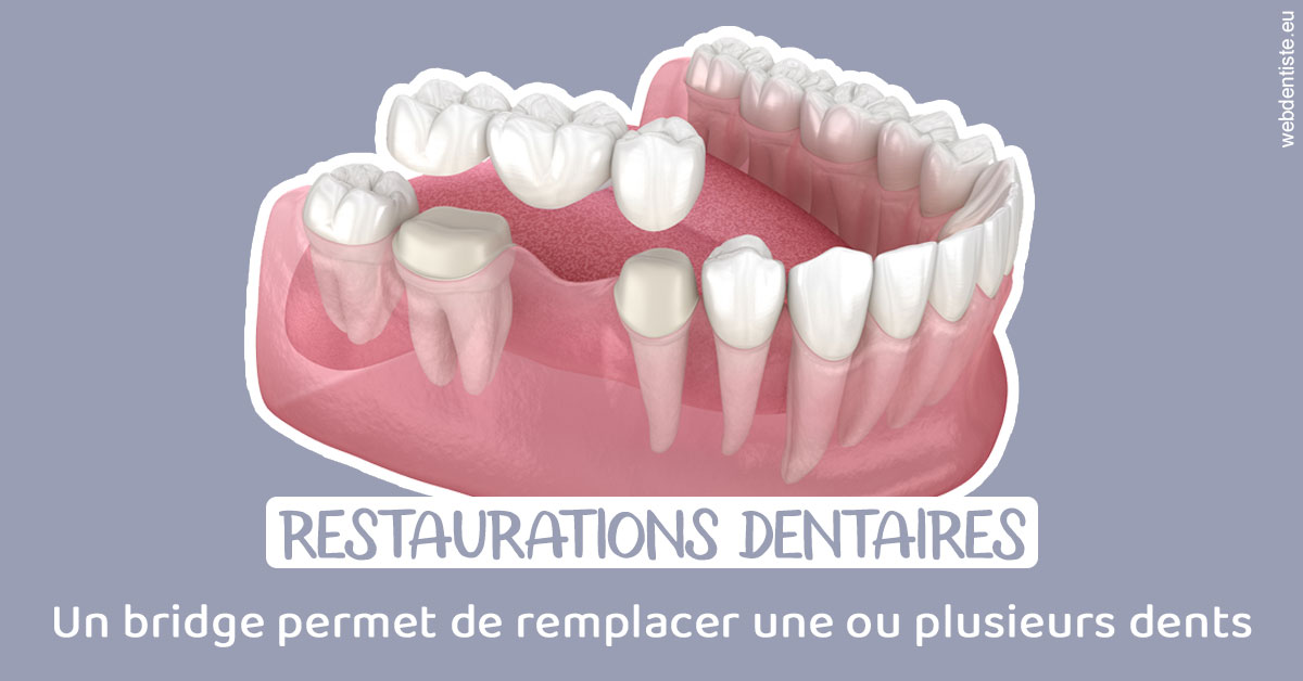 https://dr-nezri-mickael.chirurgiens-dentistes.fr/Bridge remplacer dents 1