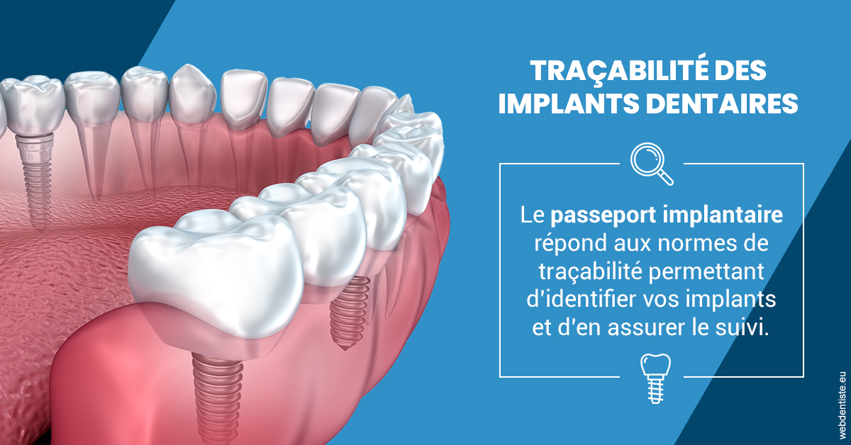 https://dr-nezri-mickael.chirurgiens-dentistes.fr/T2 2023 - Traçabilité des implants 1
