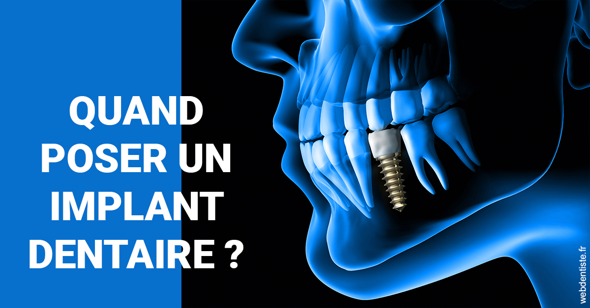 https://dr-nezri-mickael.chirurgiens-dentistes.fr/Les implants 1