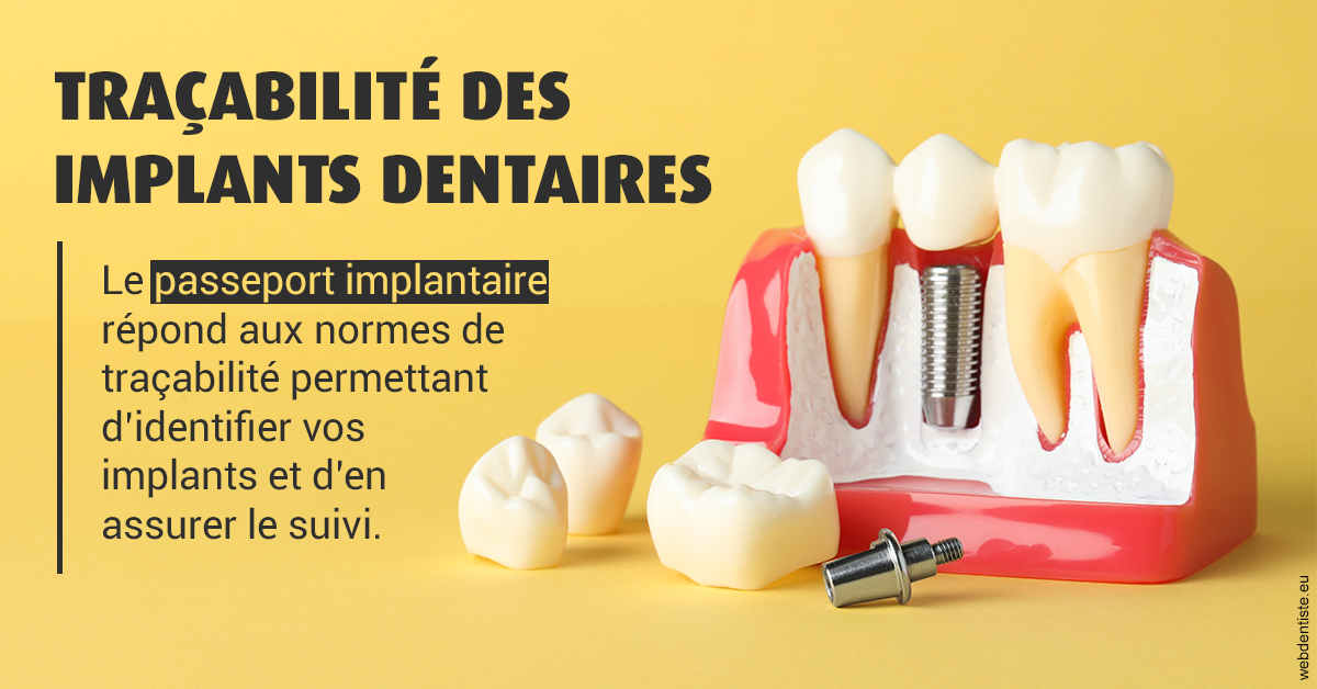 https://dr-nezri-mickael.chirurgiens-dentistes.fr/T2 2023 - Traçabilité des implants 2