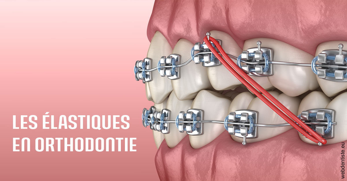 https://dr-nezri-mickael.chirurgiens-dentistes.fr/Elastiques orthodontie 2