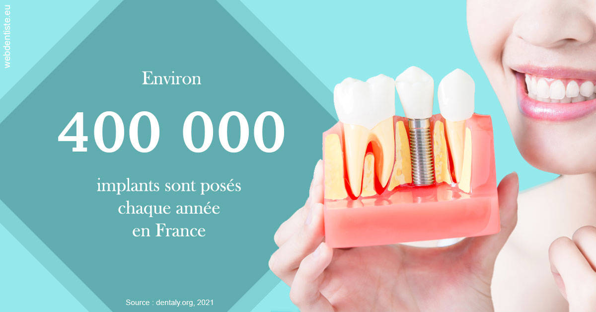 https://dr-nezri-mickael.chirurgiens-dentistes.fr/Pose d'implants en France 2